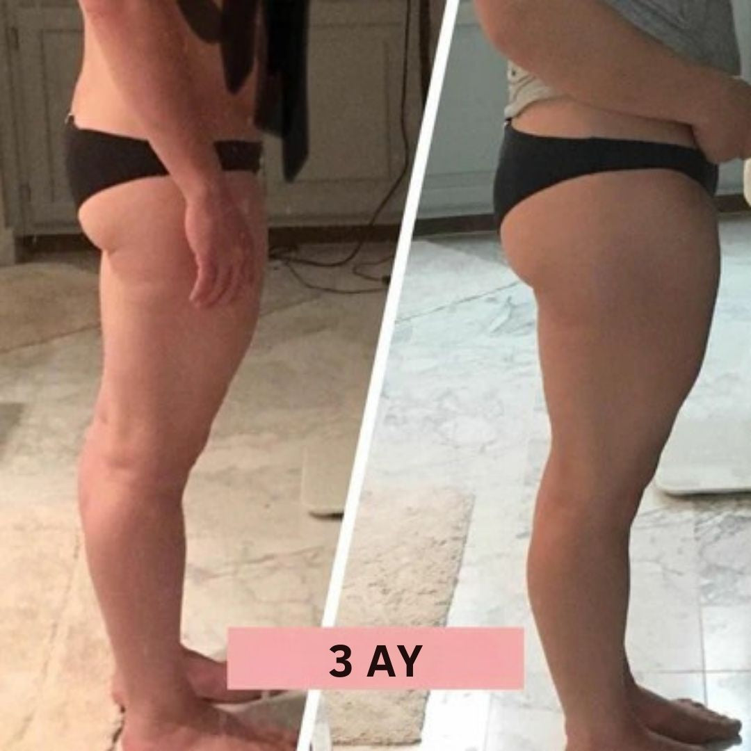 Zorvera™ BootyTrainer Kalça Şekillendirici Egzersiz Aleti